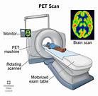 How Does a Pet Scanner Work?