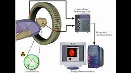 How Do PET Scans Work?