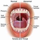 Can Pets Get Strep Throat?