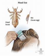 Do Pets Get Human Head Lice?