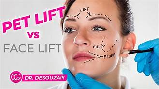 What Is a Pet Lift Face?